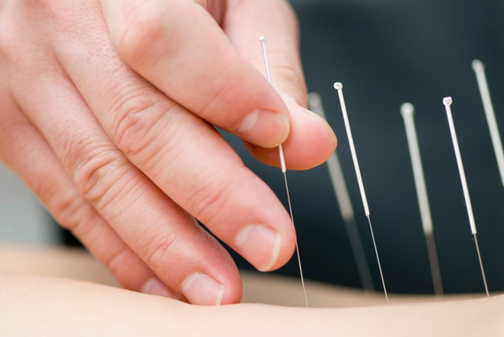 What Types of Treatment is Acupuncture Most Effective With