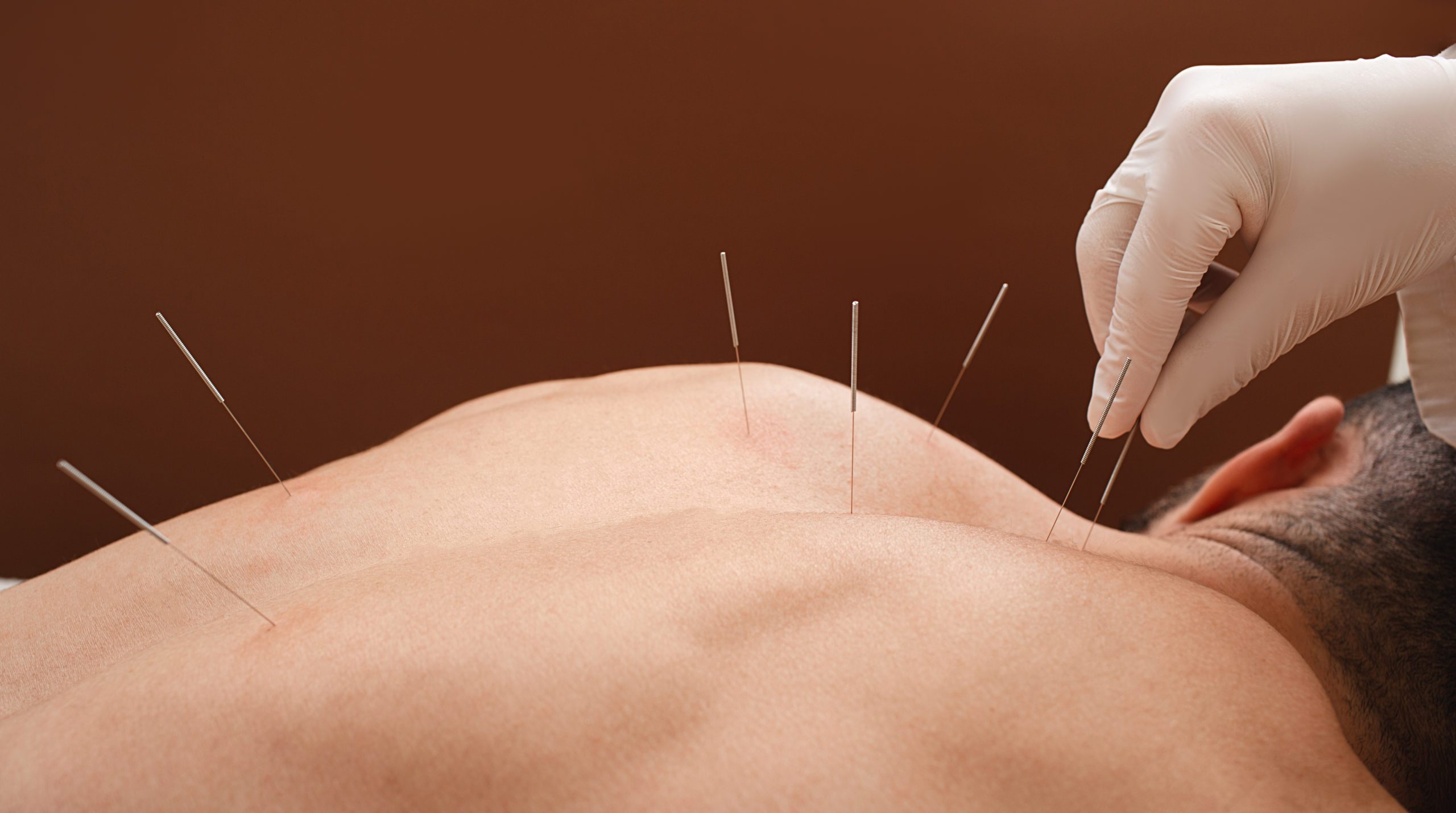 What Type of Treatments Are Acupuncture Most Effective